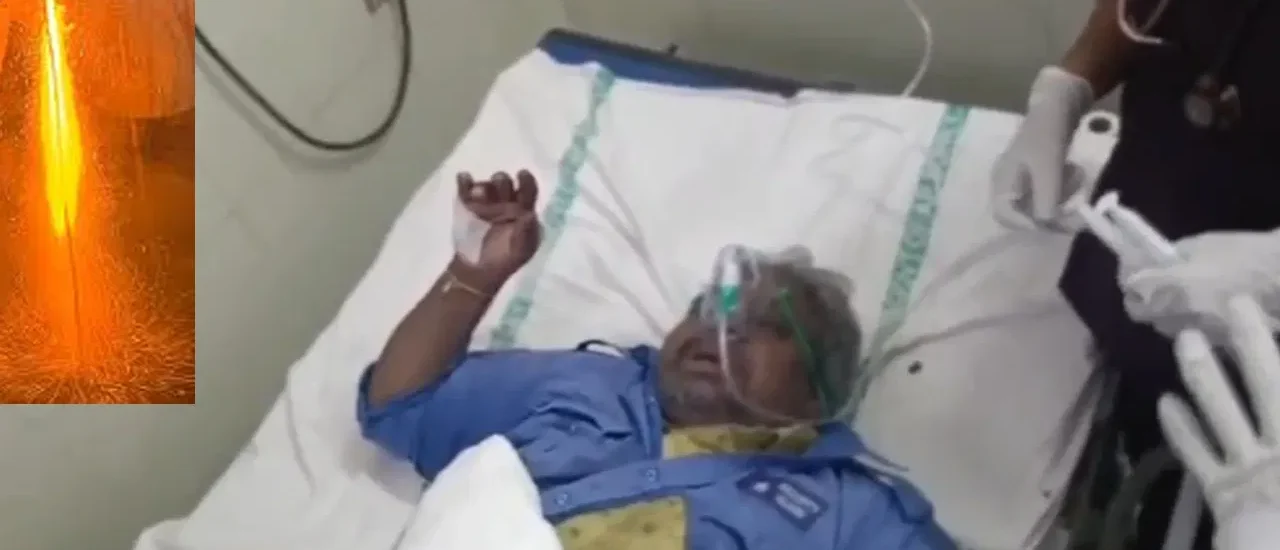 Kadapa: పొట్టలోకి దూసుకెళ్లిన తారాజువ్వ.. బయటకొచ్చిన పేగులు..